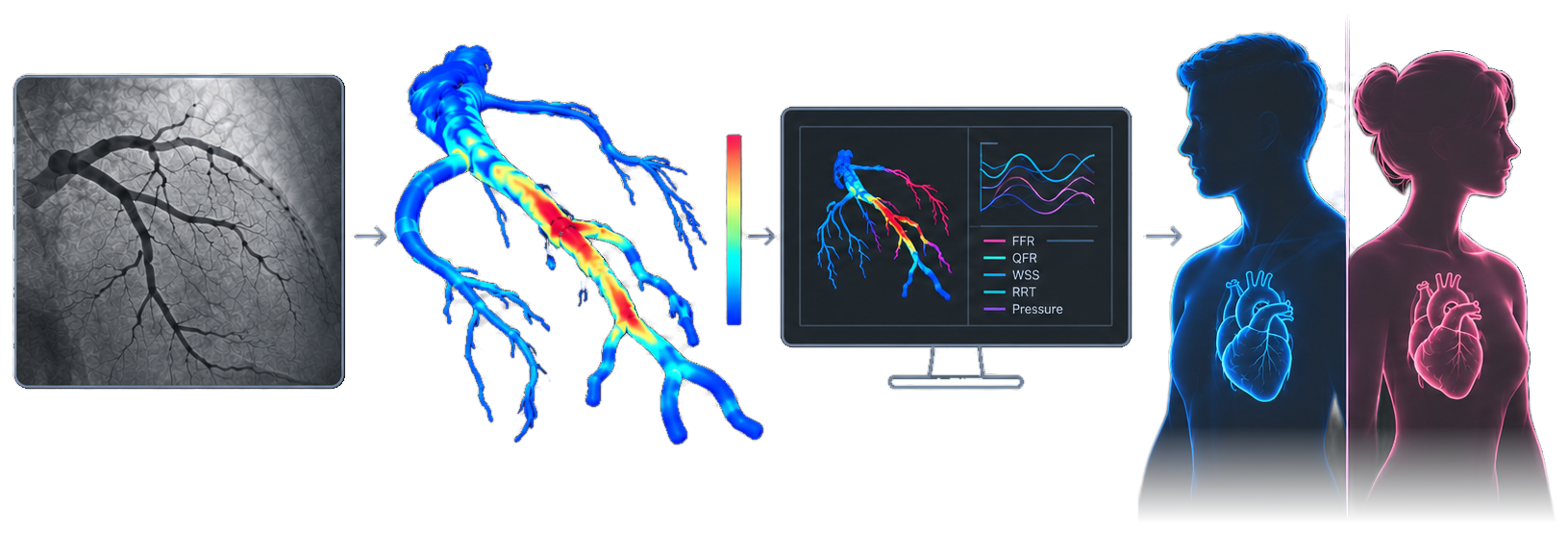 Sex-differentiated coronary hemodynamics — flow and pressure modeling